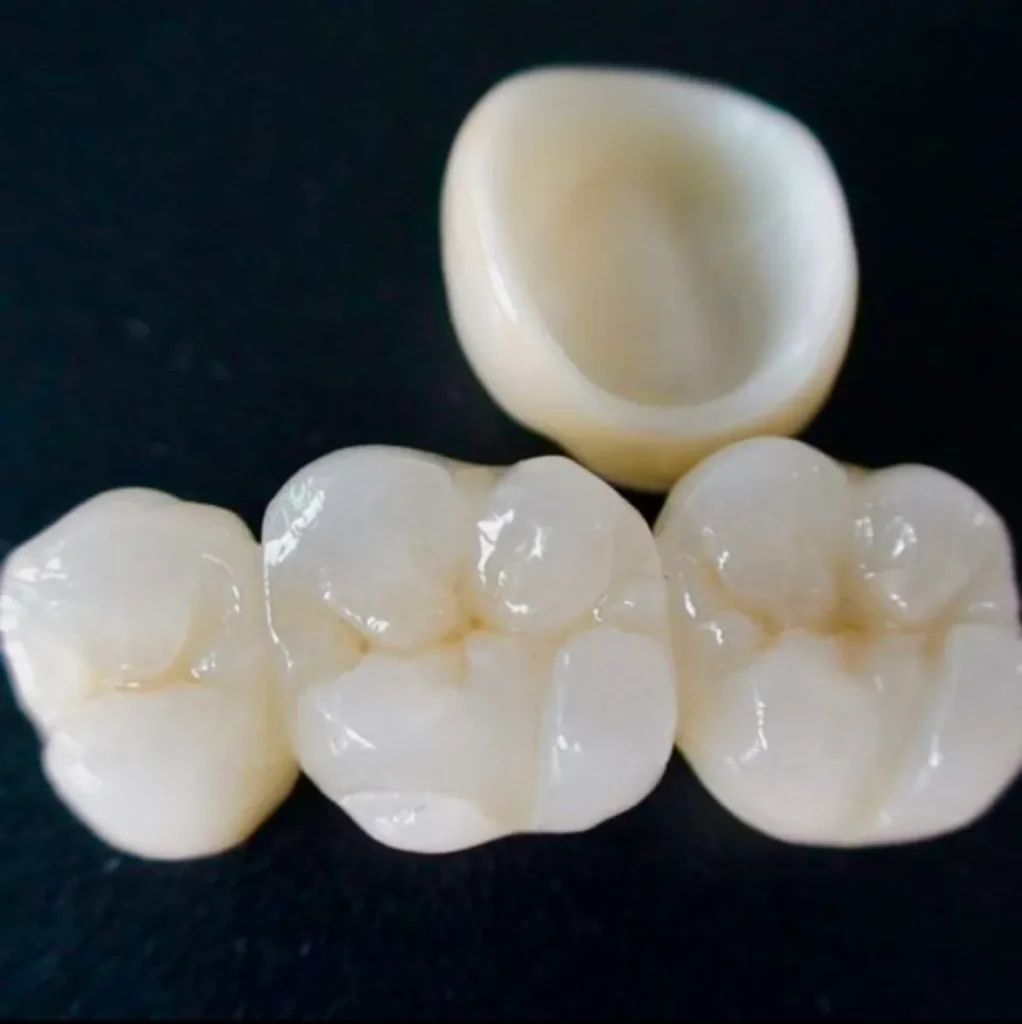 مراقبت‌های بعد از نصب پروتز ثابت | راهنمای جامع 2025