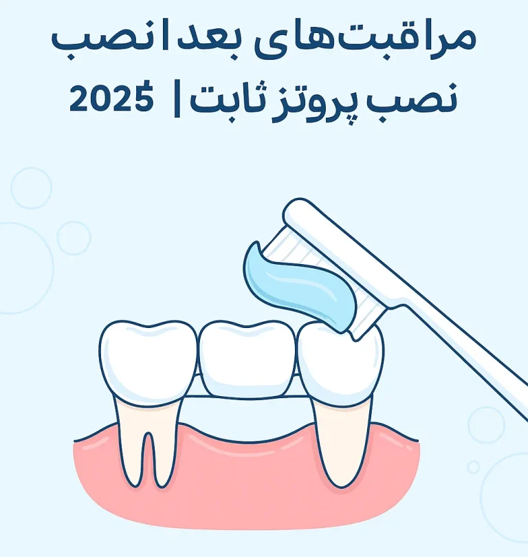 مراقبتهای بعد از نصب پروتز ثابت | راهنمای جامع 2025