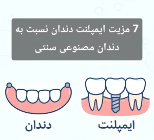 7 مزیت ایمپلنت دندان نسبت به دندان مصنوعی سنتی
