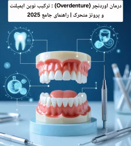 درمان اوردنچر (Overdenture) : ترکیب نوین ایمپلنت و پروتز متحرک | راهنمای جامع 2025