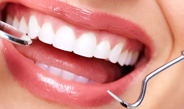 ترمیم های سرامیکی (Inlay، Onlay، Endocrown) | راهنمای جامع علم و زیبایی در دندانپزشکی 2025