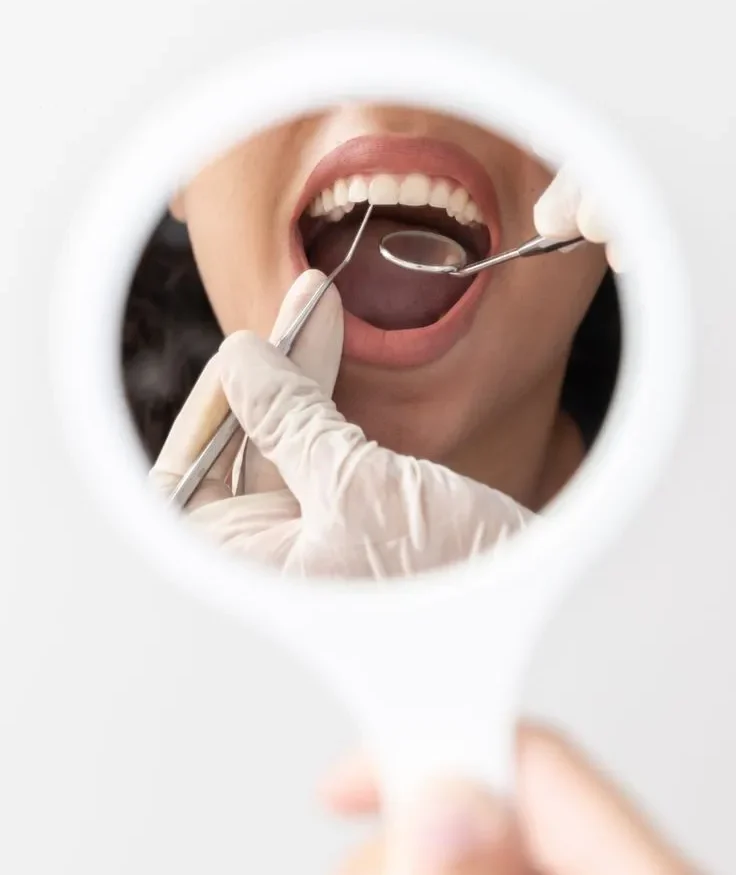 مراحل ایمپلنت دندان | راهنمای جامع 2025