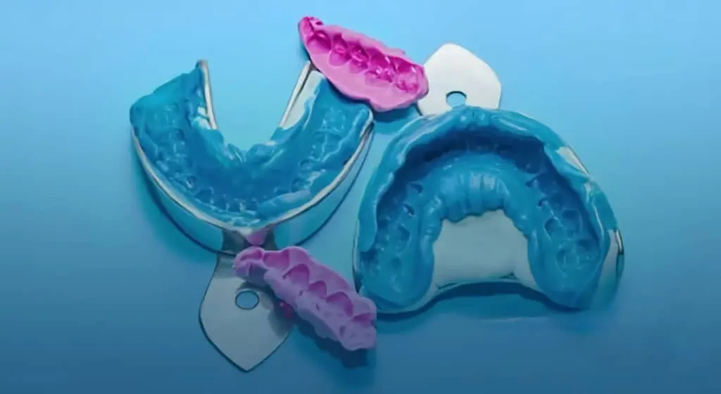 مقایسه قالبگیری دیجیتال و قالبگیری کاشال | راهنمای جامع 2025