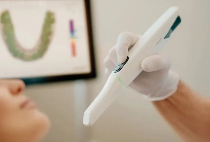 مقایسه قالبگیری دیجیتال و قالبگیری کاشال | راهنمای جامع 2025