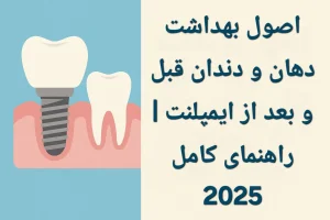 اصول بهداشت دهان و دندان قبل و بعد از ایمپلنت | راهنمای کامل 2025