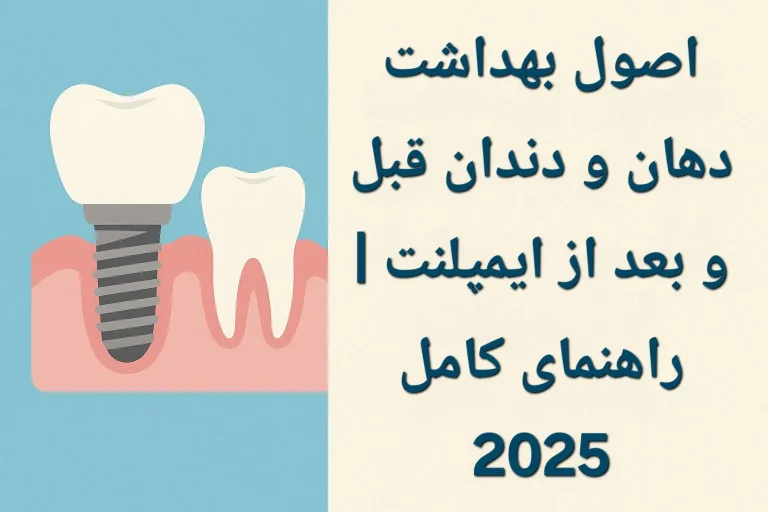 اصول بهداشت دهان و دندان قبل و بعد از ایمپلنت | راهنمای کامل 2025