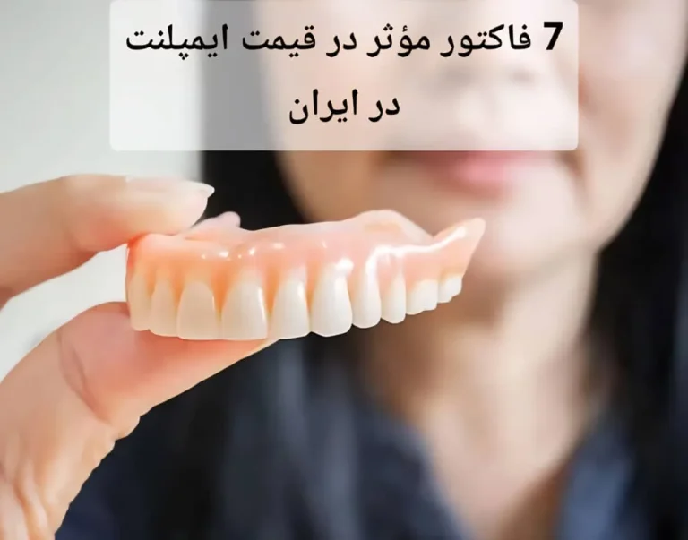 7 فاکتور مؤثر در قیمت ایمپلنت در ایران