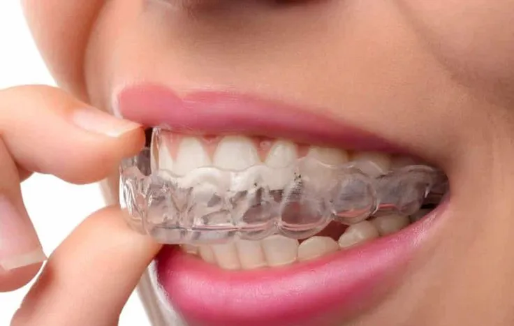 نایت گارد و درمان دندانقروچه | راهنمای جامع 2025