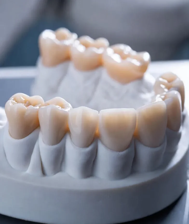 همه‌چیز درباره پروتز موقت دندان + راهنمای مراقبت 2025