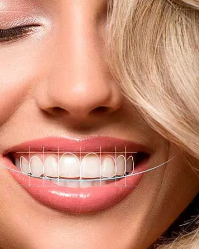 زیبایی لبخند دیجیتال: روند طراحی لبخند در 2025