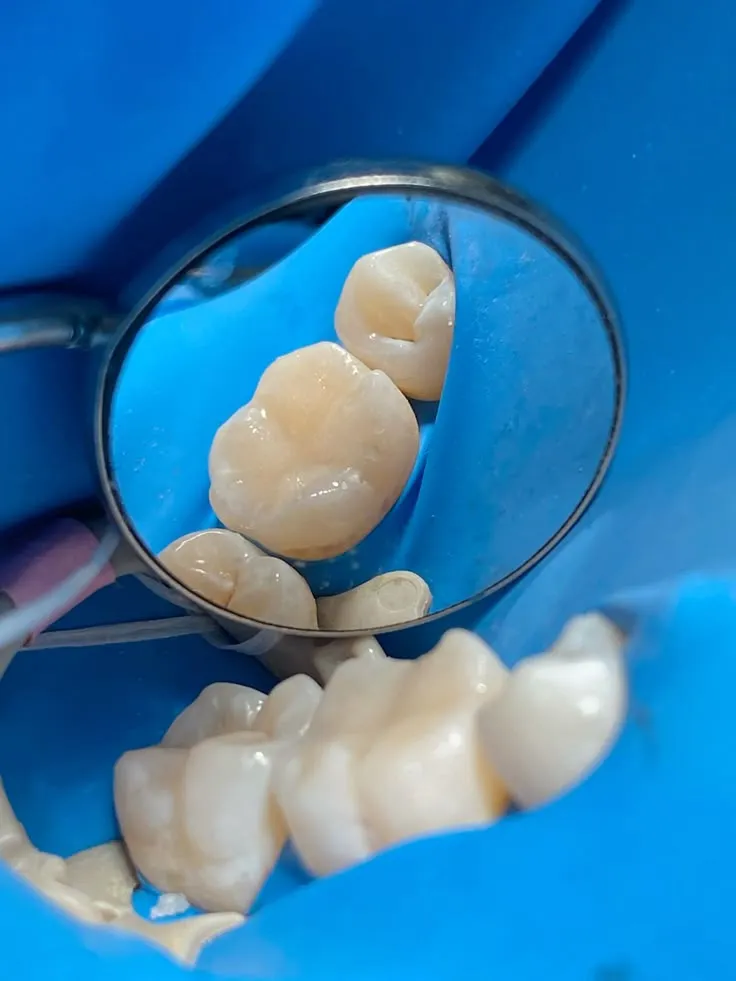 ترمیم ریشه مدرن | راهنمای جامع سال 2025