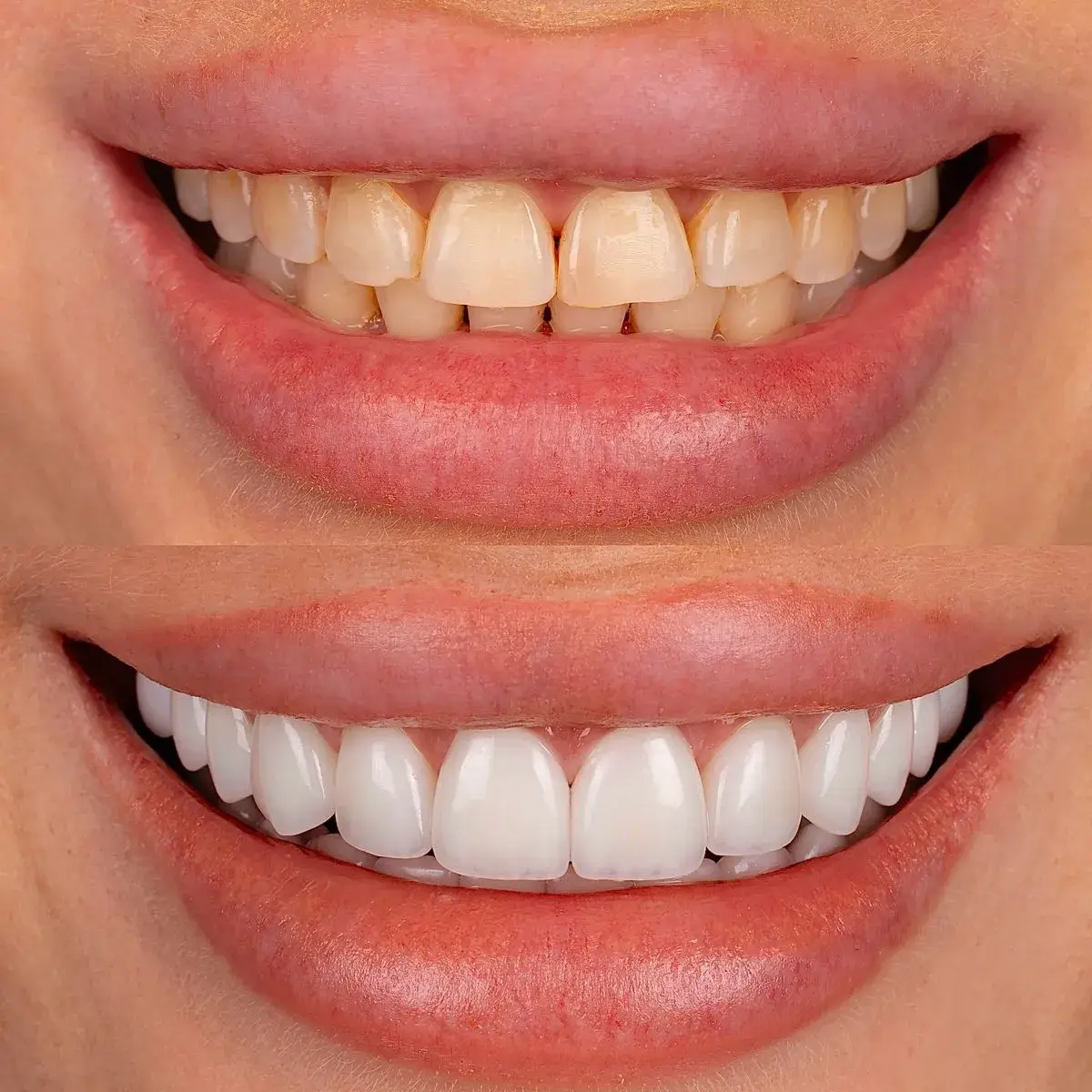 روانشناسی لبخند و تأثیر آن بر اعتماد به نفس | راهنمای جامع 2025