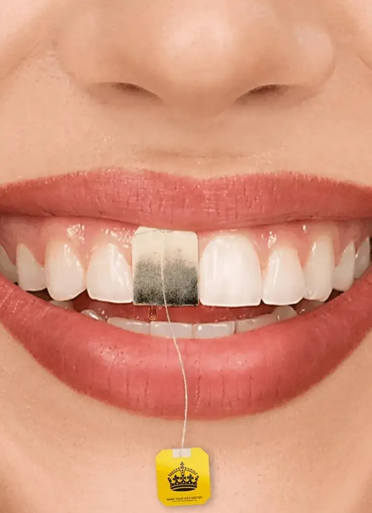 تأثیر سبک زندگی (چای، قهوه، سیگار) بر سلامت دندان | راهنمای جامع 2025