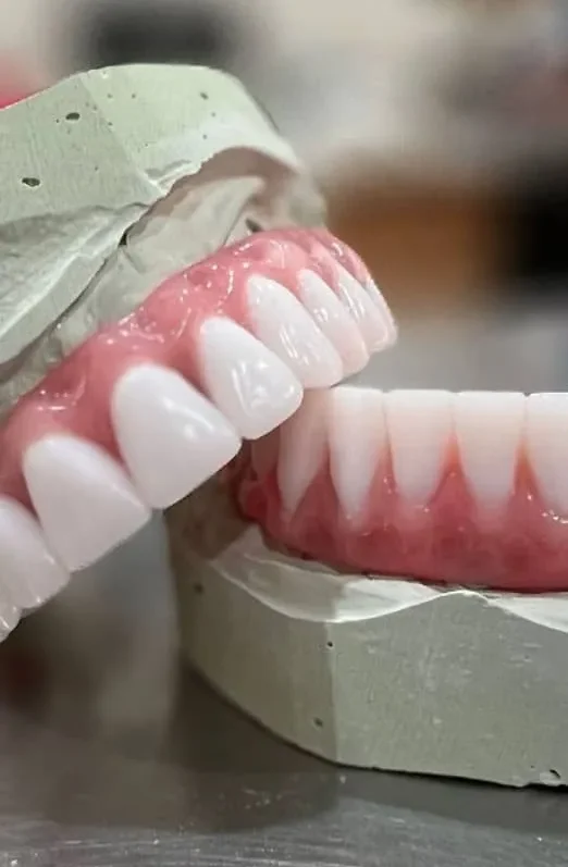 مقایسه هزینه و مزایای پروتز دندان در شهرهای مختلف ایران 1404