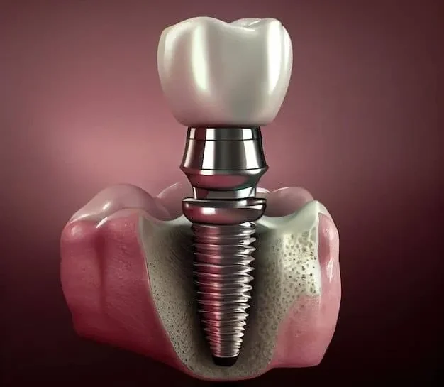 سوالات رایج بیماران قبل از ایمپلنت | راهنمای کامل و جامع 2025