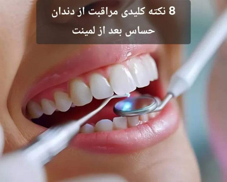 8 نکته کلیدی مراقبت از دندان حساس بعد از لمینت