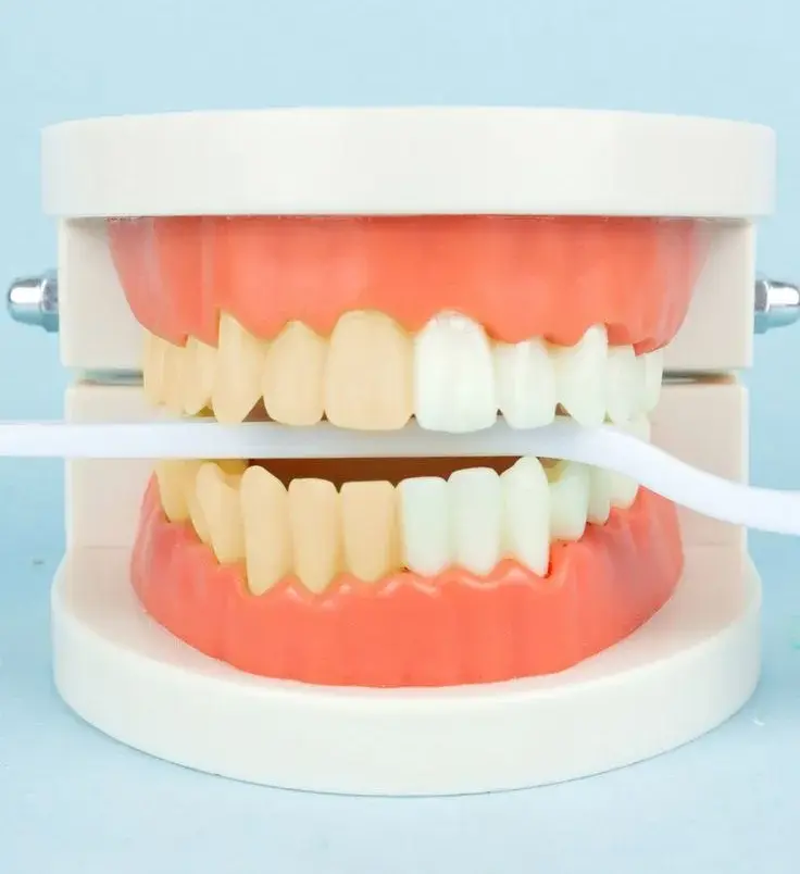 بلیچینگ خانگی ایمن 2026 | راهنمای کامل و نکات ایمنی