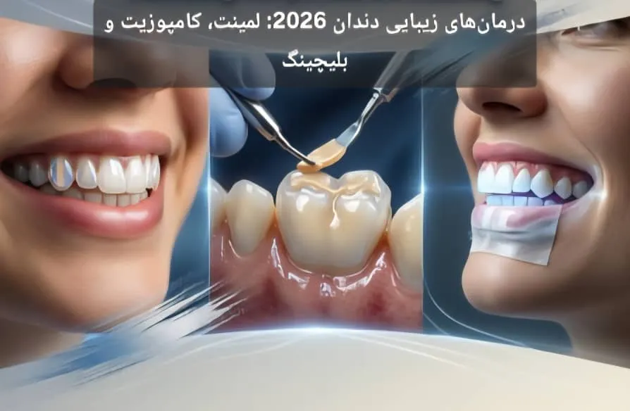 درمان‌های زیبایی دندان 2026: لمینت، کامپوزیت و بلیچینگ