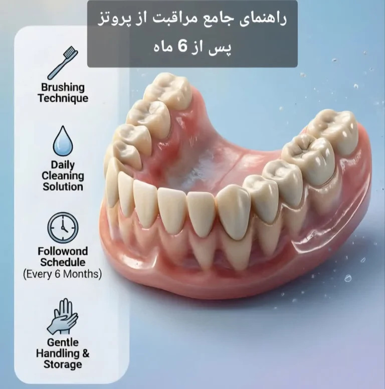 راهنمای جامع مراقبت از پروتز پس از 6 ماه