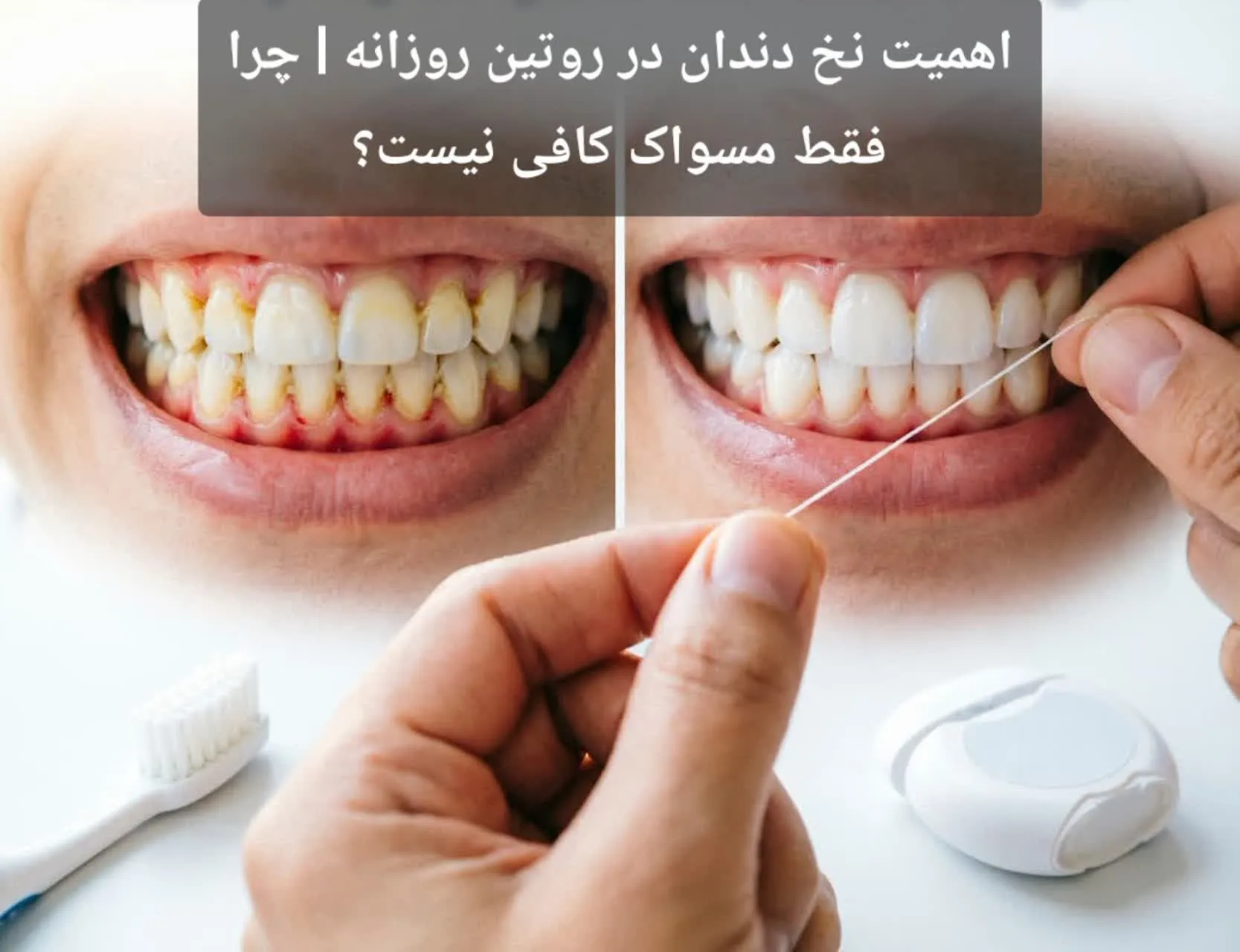 اهمیت نخ دندان در روتین روزانه | چرا فقط مسواک کافی نیست؟