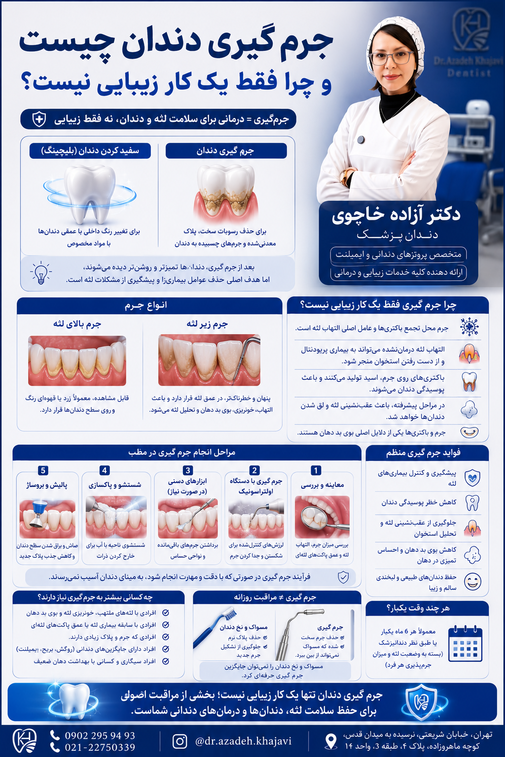 جرم گیری دندان