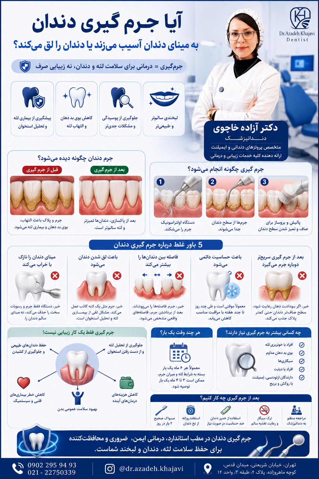 جرم گیری دندان