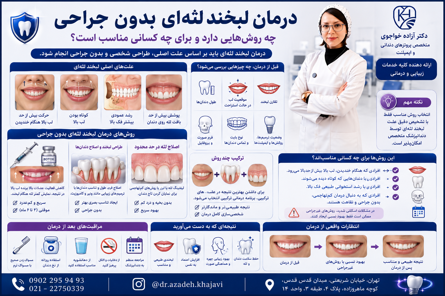 درمان لبخند لثه ای