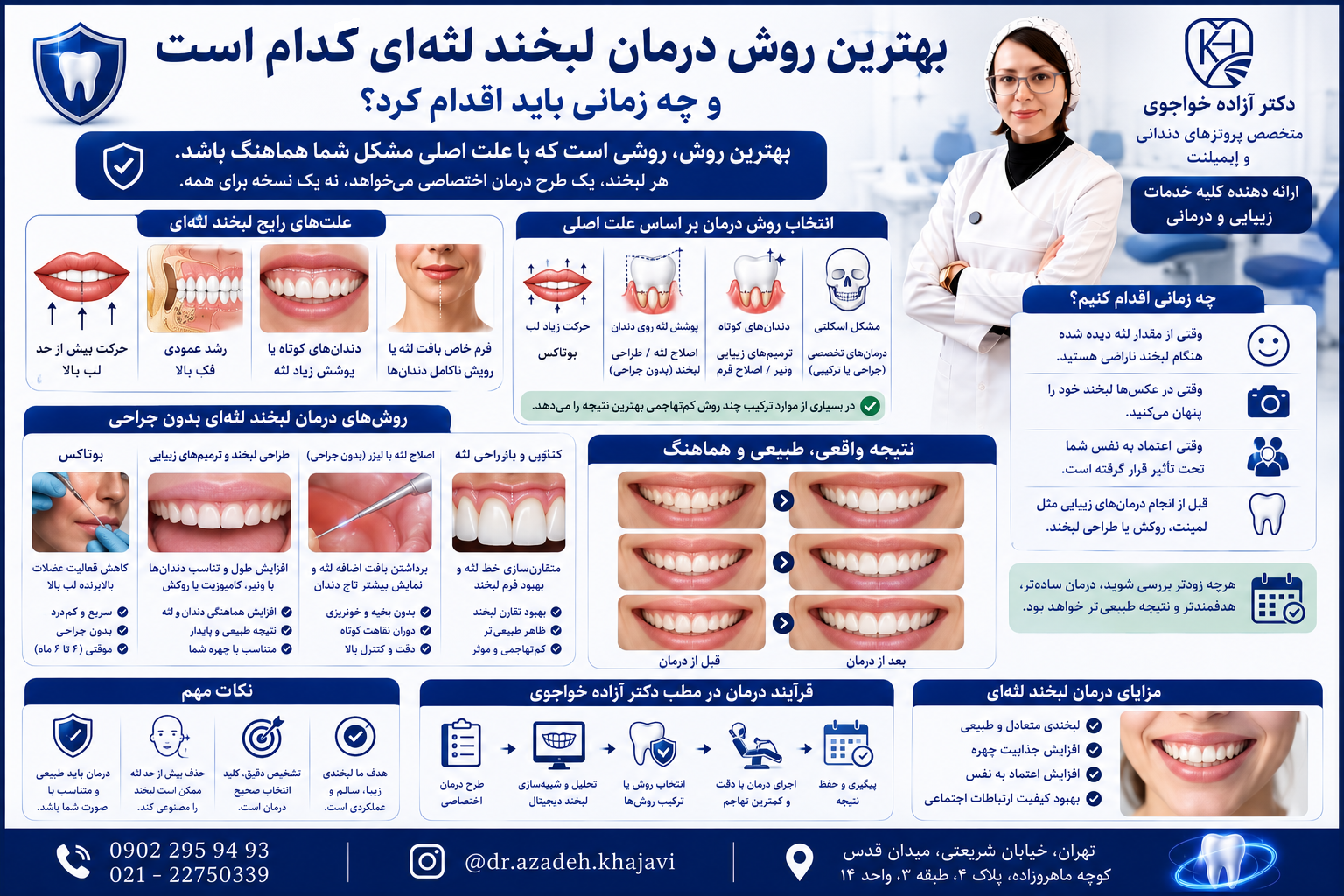 درمان لبخند لثه ای
