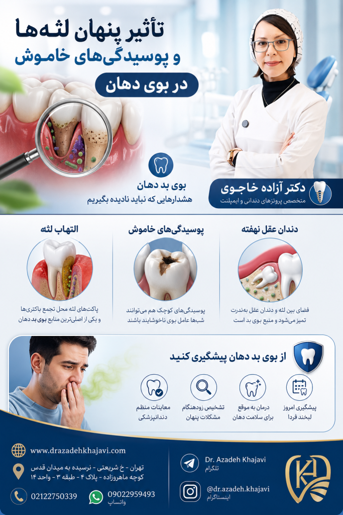 بوی بد دهان