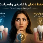 حفظ دندان یا کشیدن و ایمپلنت؛ کدام انتخاب درست است؟