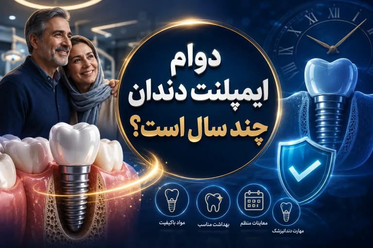 دوام ایمپلنت دندان؛ 25 سال یا بیشتر؟