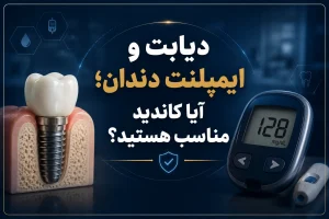دیابت و ایمپلنت دندان؛ آیا کاندید مناسب هستید؟